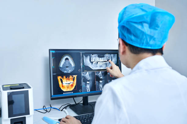 Best Emergency Root Canal Treatment in Bell, CA